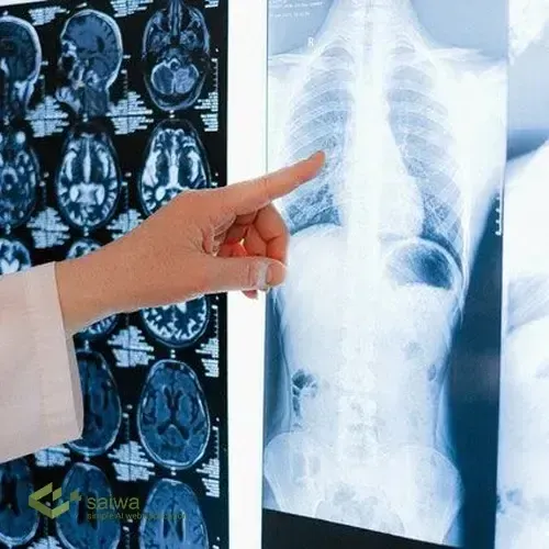 Understanding Artificial Intelligence in disease diagnosis