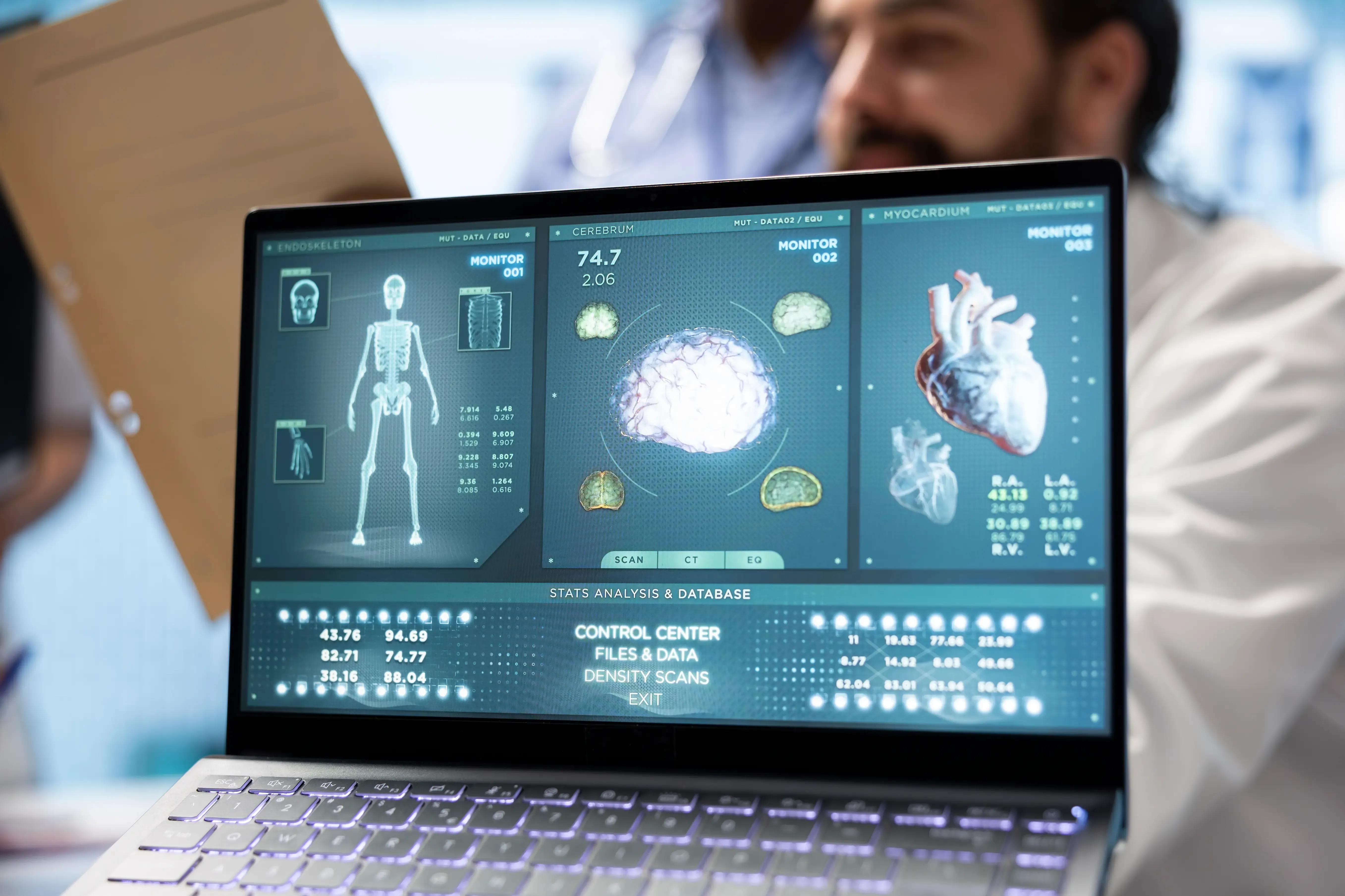 Hospital staff examine cardiovascular x ray results and discuss treatment option